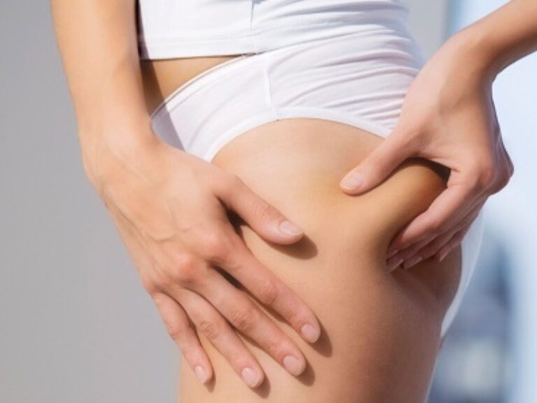 5 Bài tập giảm mỡ mông hiệu quả giúp mông săn chắn