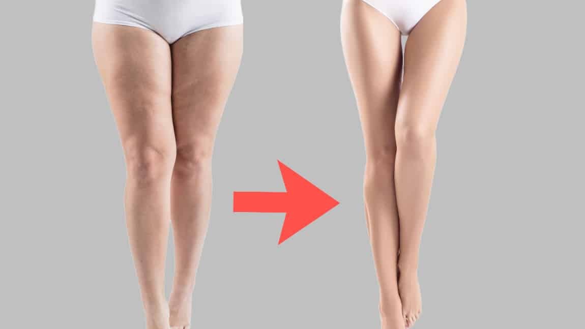 Lưu ý và những điều cần tránh khi giảm bắp chân