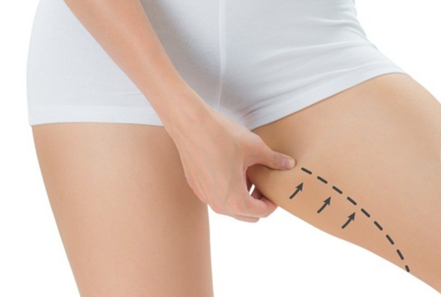 Hiểu rõ về mỡ đùi trong