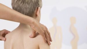 11 Bài tập giúp chữa gù lưng hiệu quả tại nhà